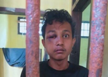Pelaku begal, Erwin Saputra bonyok usai diamuk warga lantaran aksinya bersama temannya gagal. HO/Tribun Medan