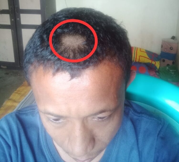Rambut guru Ulan Hadji dipotong paksa oleh oknum orang tua siswa. (Foto: Facebook/Insan Dai)