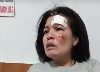 Pegawai Kodam I/BB Irawati Manurung yang jadi korban pembegalan. (Foto: Istimewa)