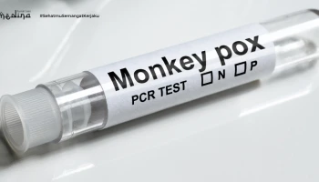 Monkeypox: Penyakit yang Perlu Kita Ketahui