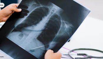 Rahasia di Balik Layar: Penyakit yang Terdeteksi Lewat Radiologi