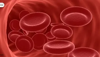 Hemofilia: Pahami Gejala dan Pengobatannya