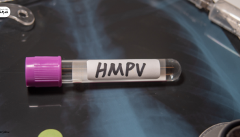 Kenali HMPV, Virus yang Bikin Susah Napas!