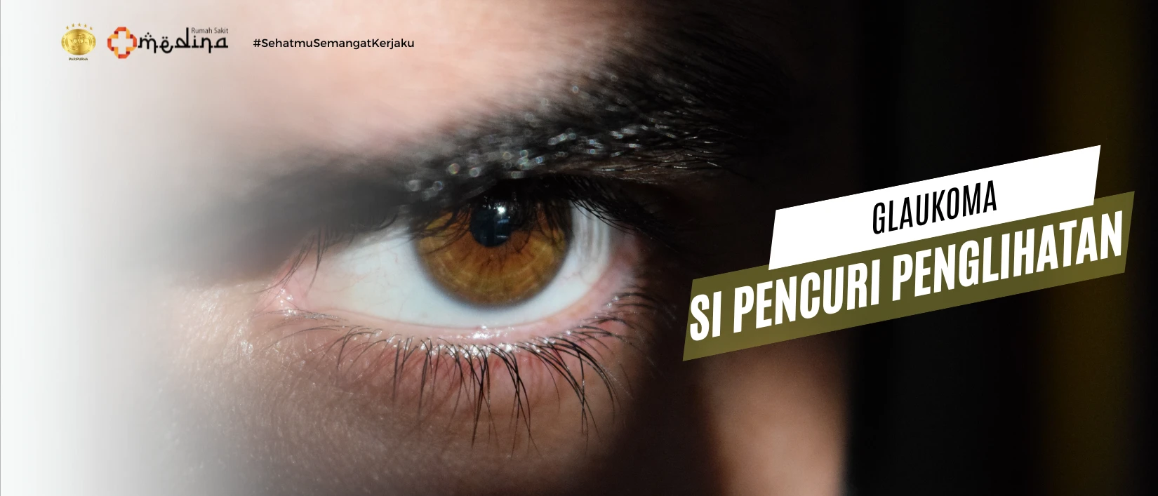 artikel kesehatan Glaukoma, Si Pencuri Penglihatan