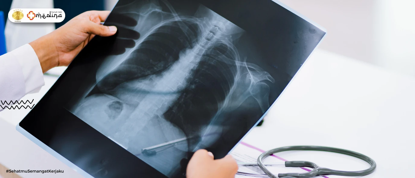 artikel kesehatan Rahasia di Balik Layar: Penyakit yang Terdeteksi Lewat Radiologi