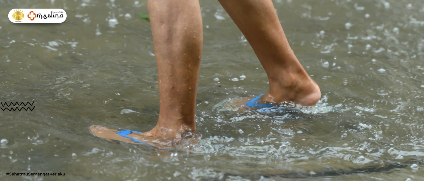 artikel kesehatan Leptospirosis: Risiko Tersembunyi di Musim Hujan yang Perlu Diketahui