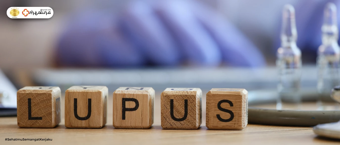 artikel kesehatan Mengenal Penyakit Lupus