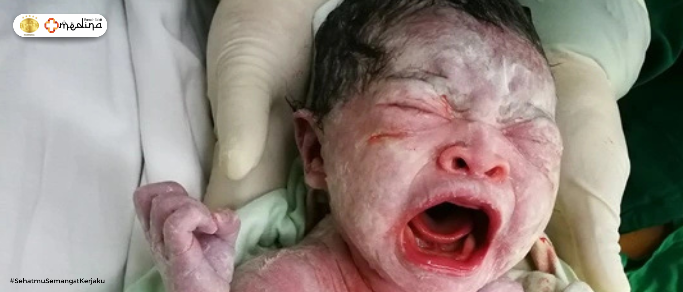 artikel kesehatan Vernix Caseosa: Lapisan Putih pada Bayi yang Penuh Manfaat
