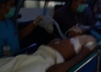 Tangan Dipotong, Anak Tentara Adukan PT Agung Beton ke Polres Siantar