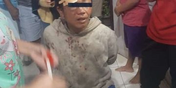 Pelaku yang dituduh culik babak belur
Foto: IST