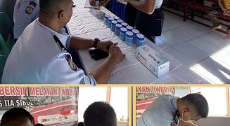 Test urine