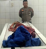 Korban tabrak lari di ruang jenazah.