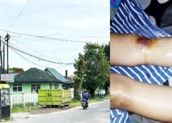 Kontainer sampah yang ambil korban