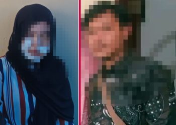 Istri yang wajahnya disayat sang suami