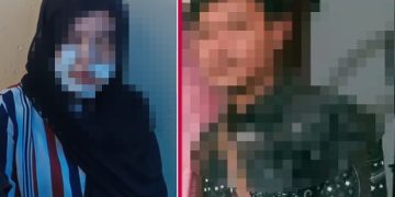 Istri yang wajahnya disayat sang suami