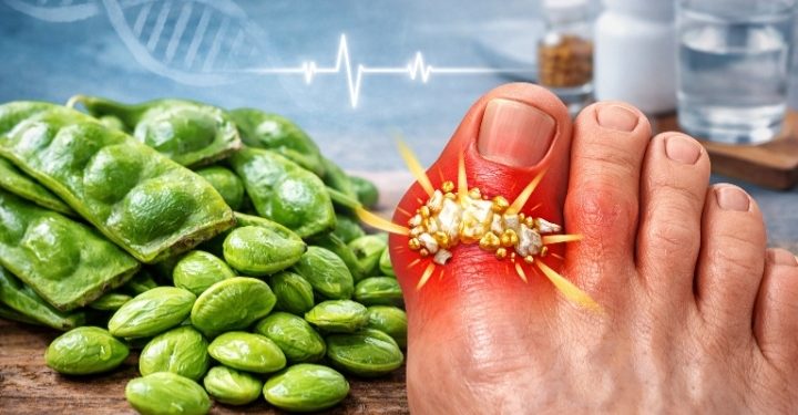 Tak Disangka! Petai yang Bau Ini Justru Bikin Asam Urat Tak Berkutik