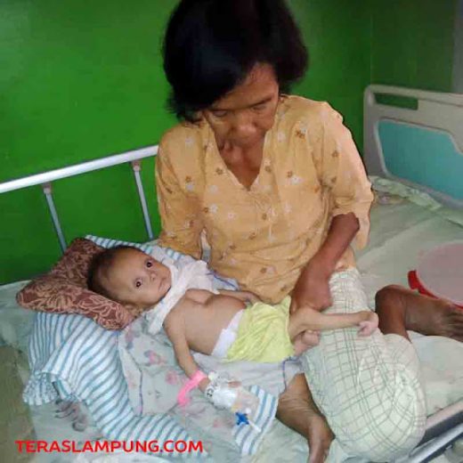 Dibawa dari Baturaja dan Dirawat di RSUD Ryacudu, Bayi Penderita Gizi Buruk Kini Mulai Membaik