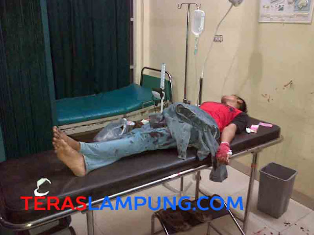 Gagal Rampas Sepeda Motor, Pembegal Bacok Korbannya