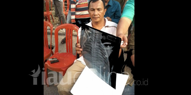 Korban Asap Riau, Bocah Kecil Menembuskan Napas Terakhir Jelang Azan Subuh