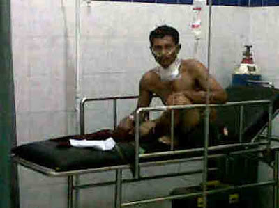 Diduga Coba Bunuh Diri, Sunyoto Nyaris Tewas dengan Luka Gorok di Leher