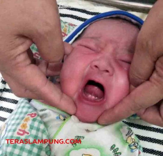 Bayi Baru Lahir Sudah Tumbuh Gigi Bikin Heboh Warga Kotabumi