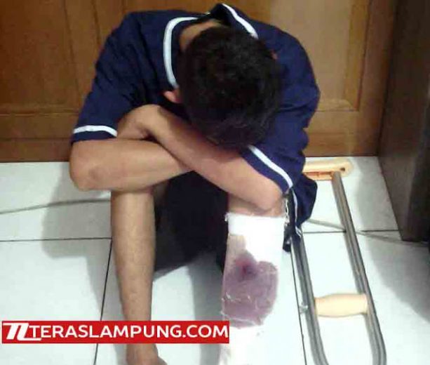 Tekab 308 Polda Lampung Tembak Pencuri Sepeda Motor