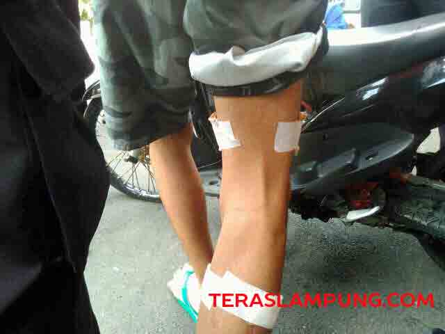 Tersangka Begal dengan Sasaran Muda-Mudi Sedang Pacaran Dihadiahi Timah Panas