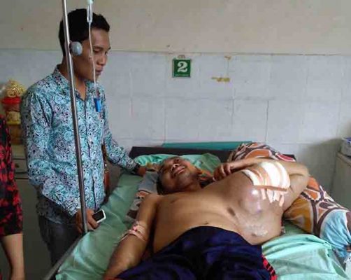 Mengidap Tumor Ganas, Sarwanto Butuh Uluran Tangan Para Dermawan
