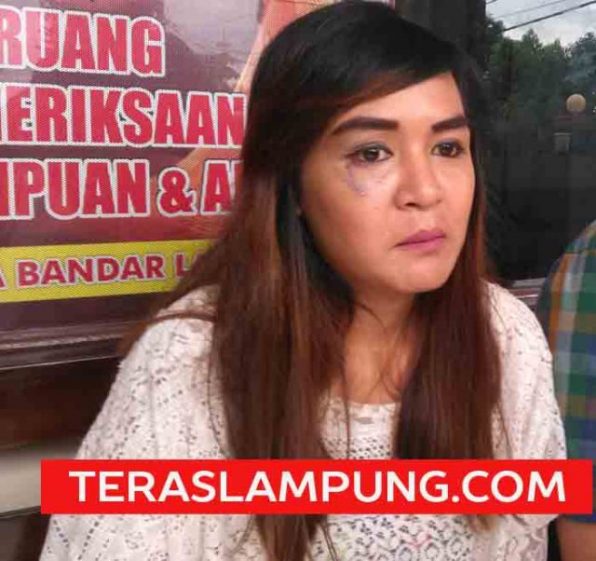 Ini Pengakuan Istri Andika Eks Vokalis Kangen Band tentang KDRT yang Dialaminya