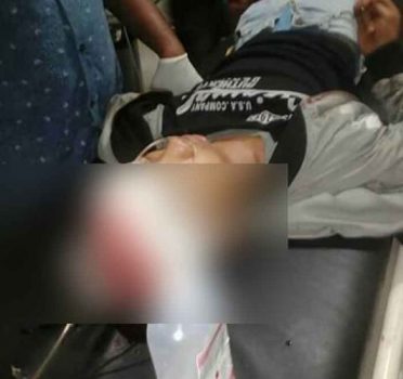 Tolong Korban Begal, Hariyanto Malah Ditembak Kepalanya