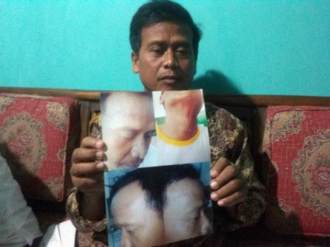 Pelaku Dibiarkan Bebas, Korban Pengeroyokan Kecewa dengan Polsek Sidomulyo