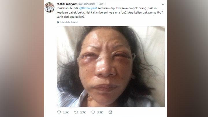 Polisi Incar Penyebar Berita Bohong Penganiayaan Ratna Sarumpaet