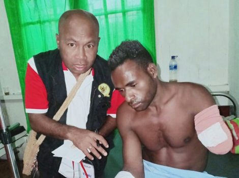 Korban Penembakan Aparat TNI di Asmat Terpaksa Diamputasi