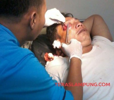 Kawanan Begal Bersenjata Api kembali Sebar Teror di Lampura