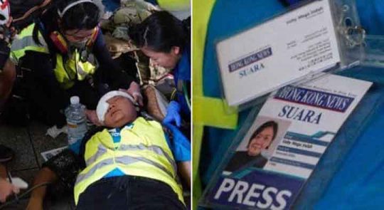 Anggotanya Ditembak, AJI Jakarta Kecam Polisi Hong Kong