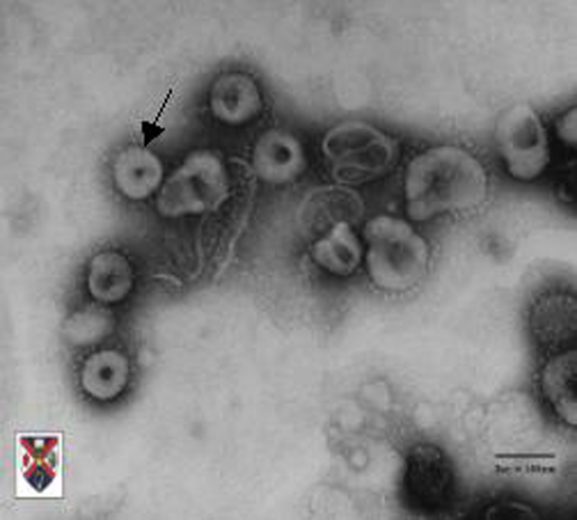 Virus Corona dan Penyakit SARS