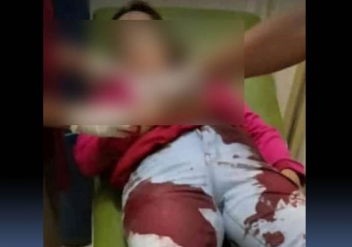 Suami Dalangi Pembunuhan Istri Sendiri, Ini Kata Polda Lampung