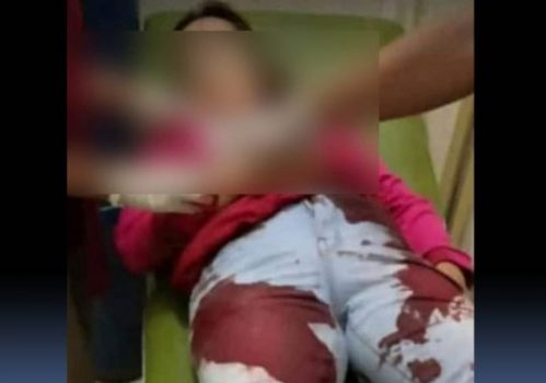Suami Dalangi Pembunuhan Istri Sendiri, Ini Kata Polda Lampung
