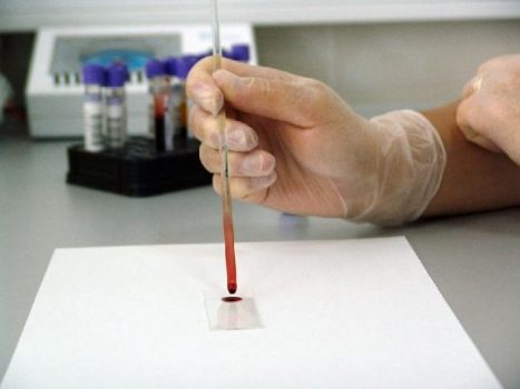 Sebagian Dokter Menolak Rapid Test Virus Corona, Ini Sebabnya
