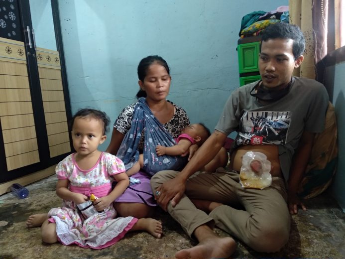 Dua Tahun Menderita Tumor, Warga Bandarlampung Ini Butuh Uluran Tangan