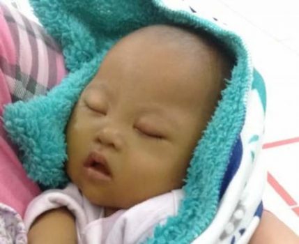 Kelainan Jantung dan Gagal Hati , Bayi 4,5 Bulan di Tanggamus Butuh Bantuan