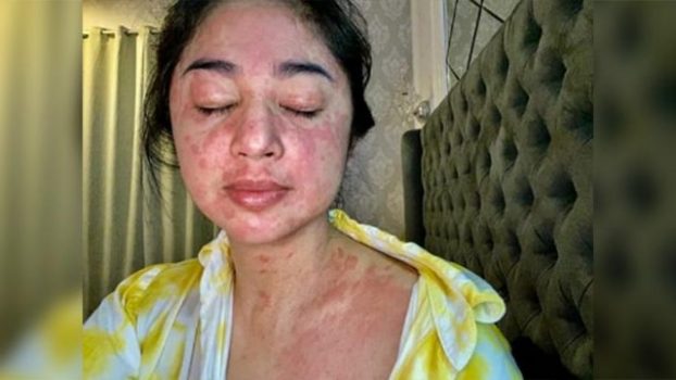 Sembuh dari Covid-19, Ini Kondisi Dewi Perssik Sekarang