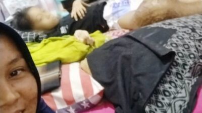 Kasus Anak Penderita Kanker Tulang, Ini Kata Kadis Kesehatan Lampung Selatan