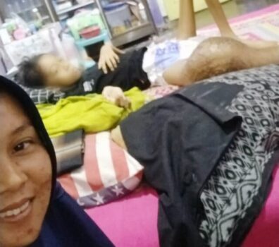 Kasus Anak Penderita Kanker Tulang, Ini Kata Kadis Kesehatan Lampung Selatan