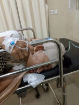 Remaja di Bandarlampung jadi Korban Penganiayaan  Geng Motor, Kondisinya Koma di RSU Abdul Moeloek