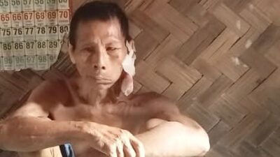 Miris! Kakek di Palas Menderita Kanker dan Tinggal di Rumah Reyot Tanpa Tersentuh Bantuan
