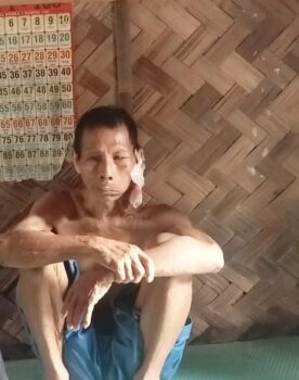 Miris! Kakek di Palas Menderita Kanker dan Tinggal di Rumah Reyot Tanpa Tersentuh Bantuan